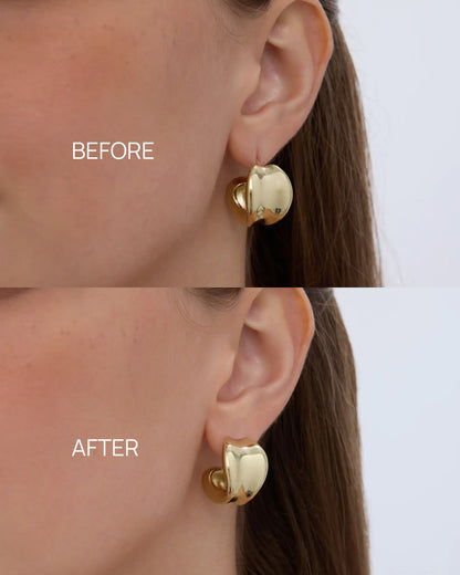 💥Buy 1 get 1 free 🔥✨ Lobe Lifters for Heavy Earrings | Weight-Distributing Earring Backs for Stretched & Droopy Earlobes | Instant Pulling Relief Today, Earlobe Protection for Every Future Wear