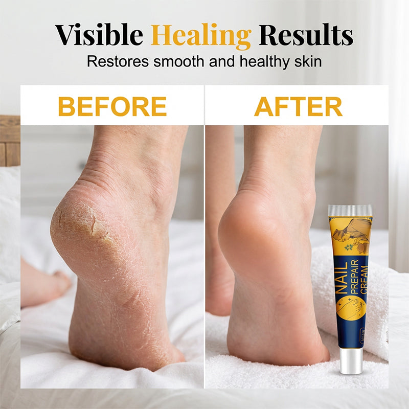 Intensive Moisturizing Foot Cream | Deep Hydration for Dry, Rough & Cracked-Looking Heels