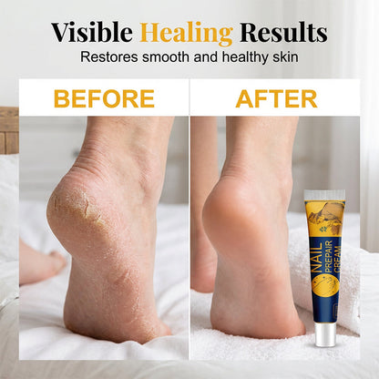 Intensive Moisturizing Foot Cream | Deep Hydration for Dry, Rough & Cracked-Looking Heels