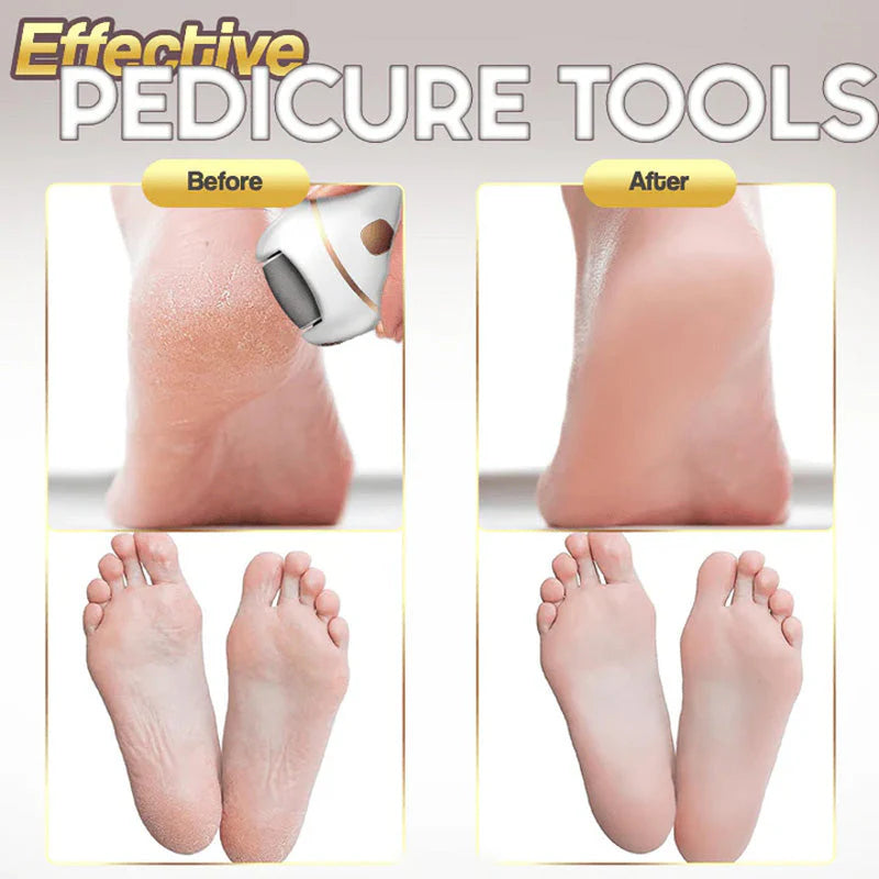 ⏰Rechargeable Electric Foot Exfoliating Scrubber